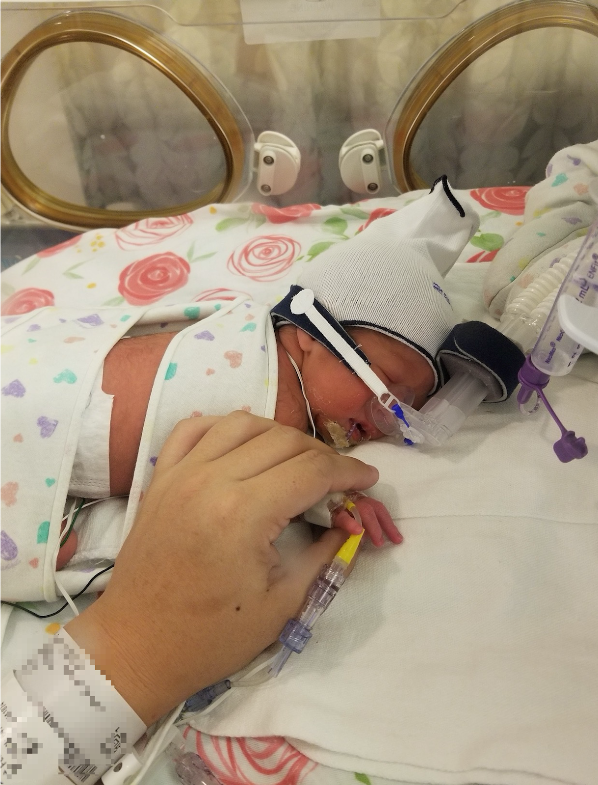 Maile Waite's baby Hailey in the NICU