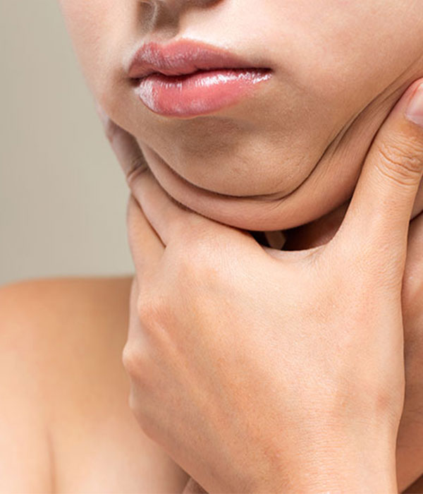 Can A Double Chin Return After Facial Liposuction?