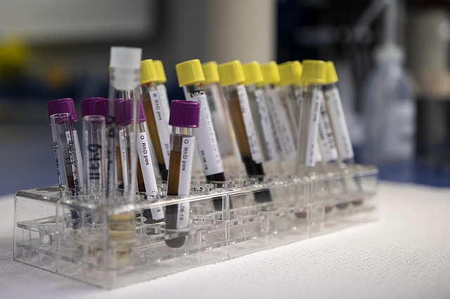 blood samples