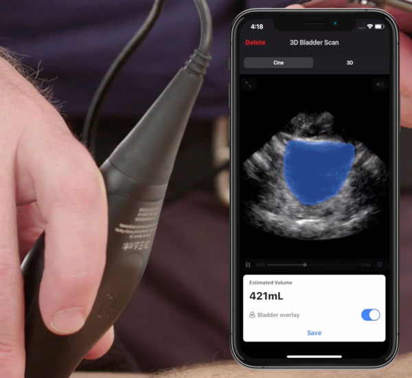 Point of care ultrasound at the bedside for Nurses Butterfly iQ+