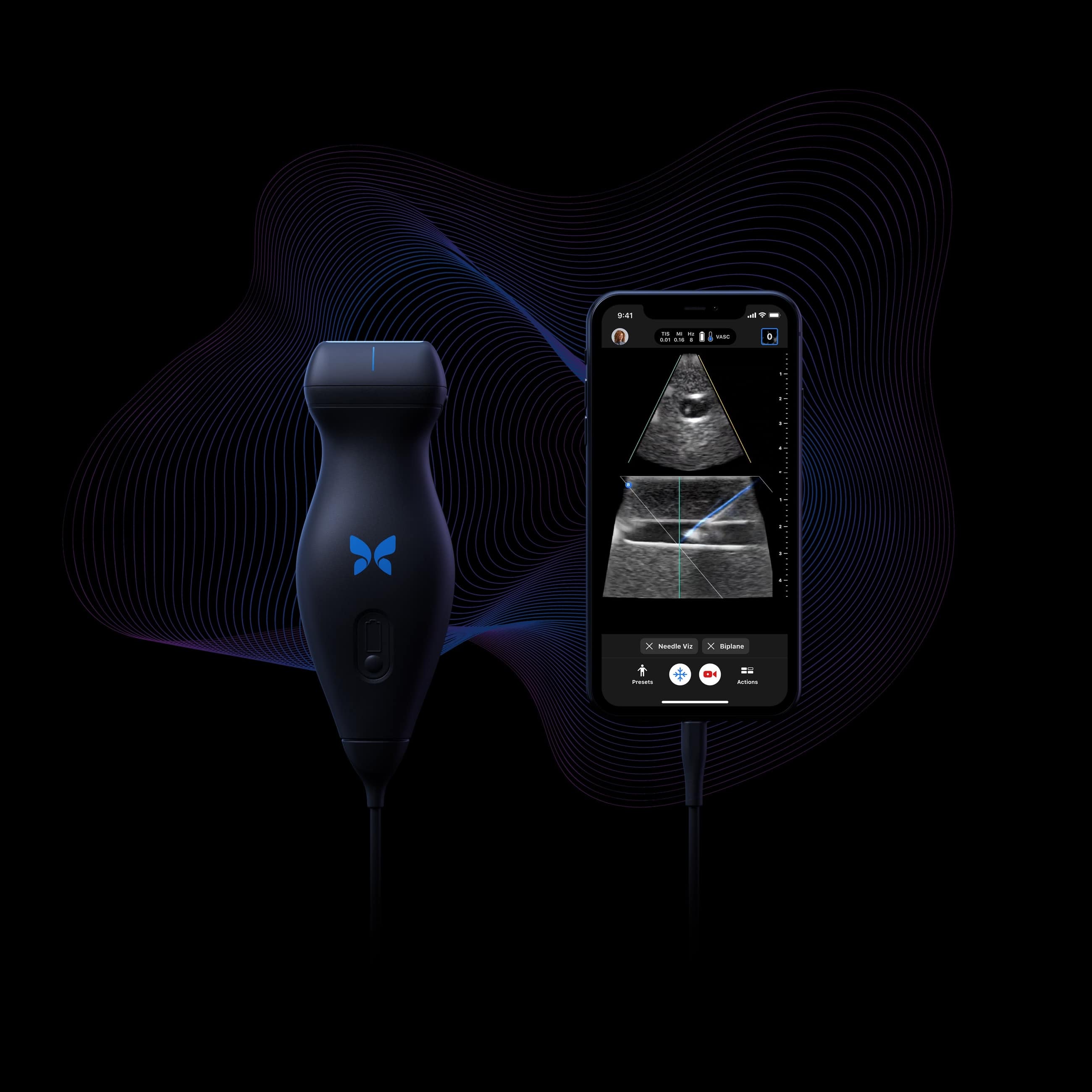 One probe, wholebody imaging Butterfly iQ+