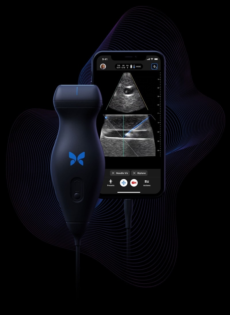 One probe, wholebody imaging Butterfly iQ+