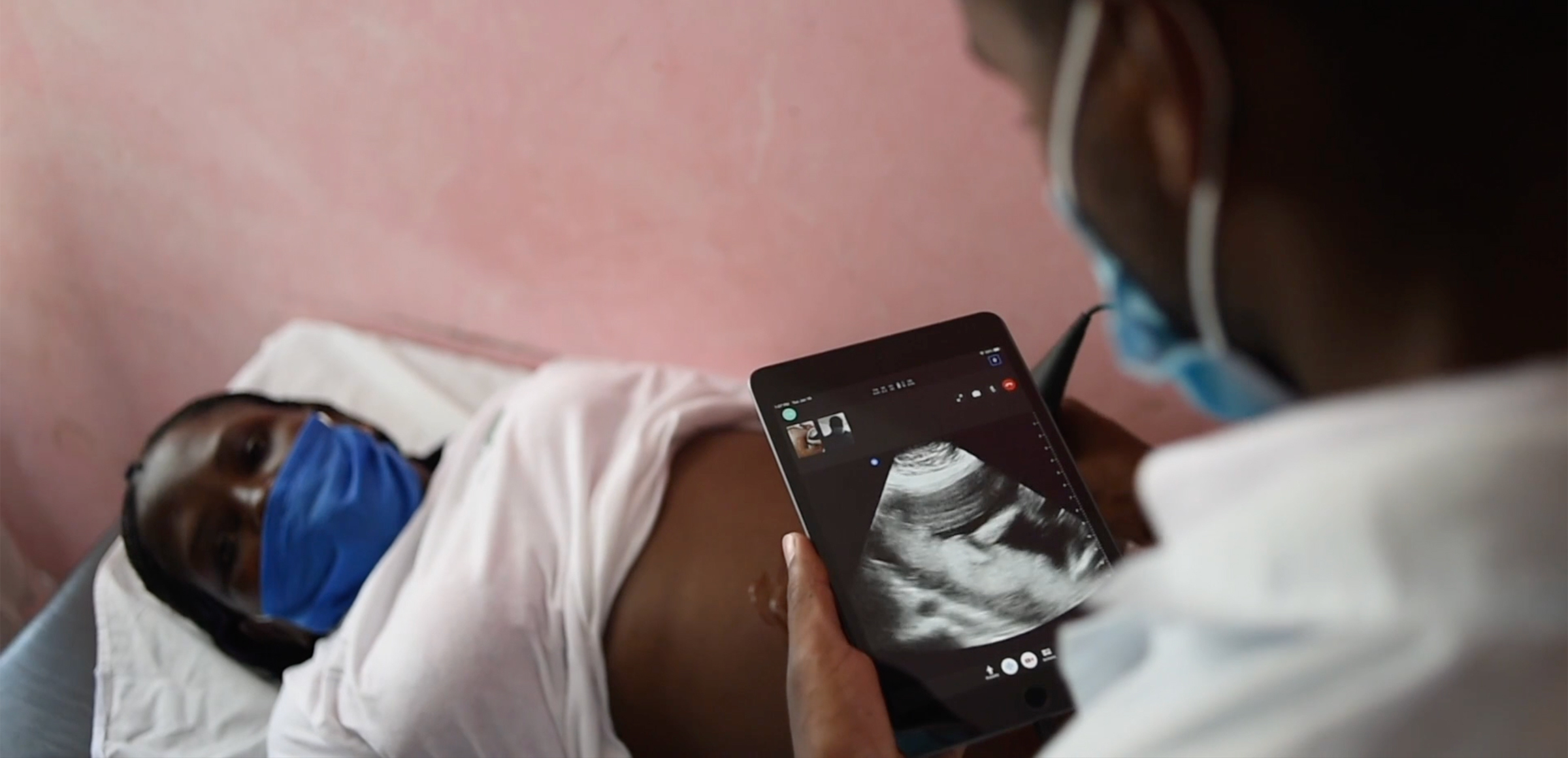 Portable ultrasound for OB/GYN and Labor & Delivery Butterfly iQ3