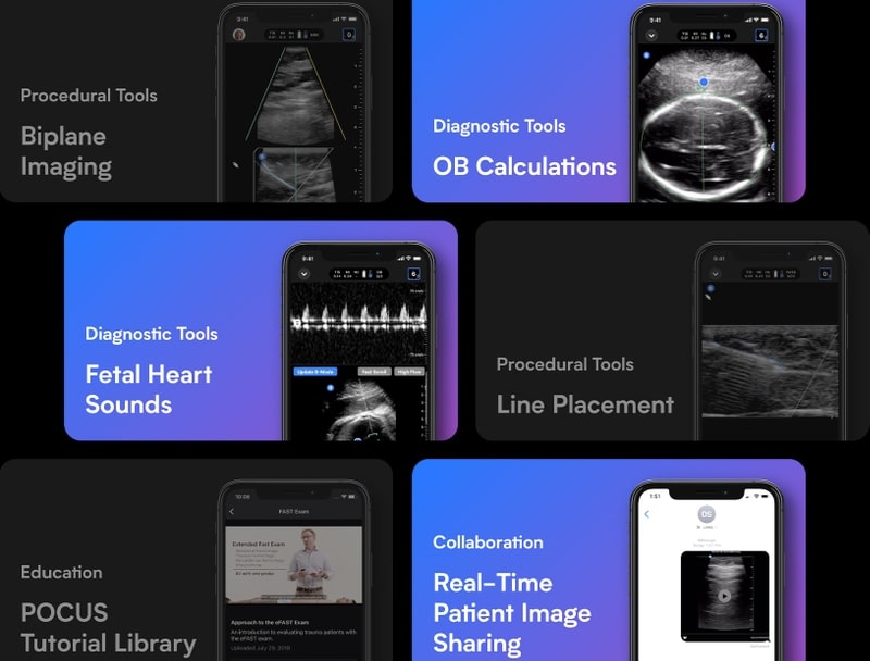 Handheld point-of-care ultrasound for OB/GYN | Butterfly iQ+