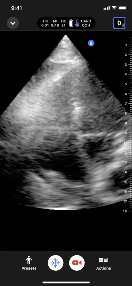 Butterfly Patient assessment, transformed.