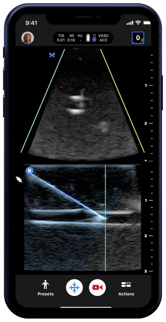 Butterfly Patient assessment, transformed.