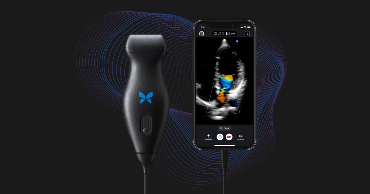 Butterfly Network Recognized As "Best New Ultrasound Solution" By MedTech Breakthrough
