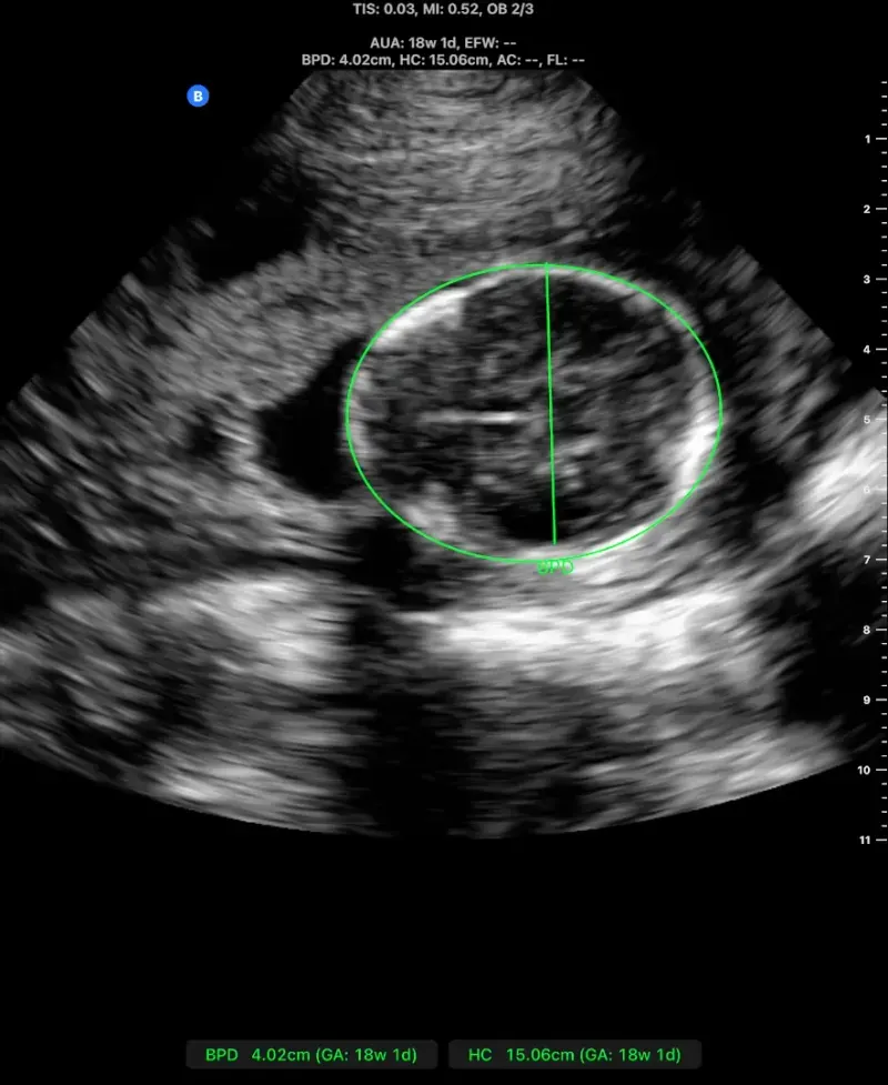 Descrição da Imagem