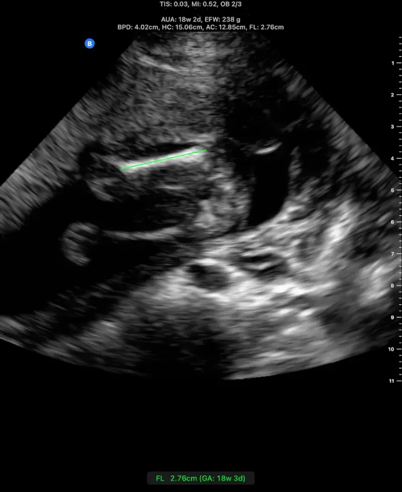 Descrição da Imagem