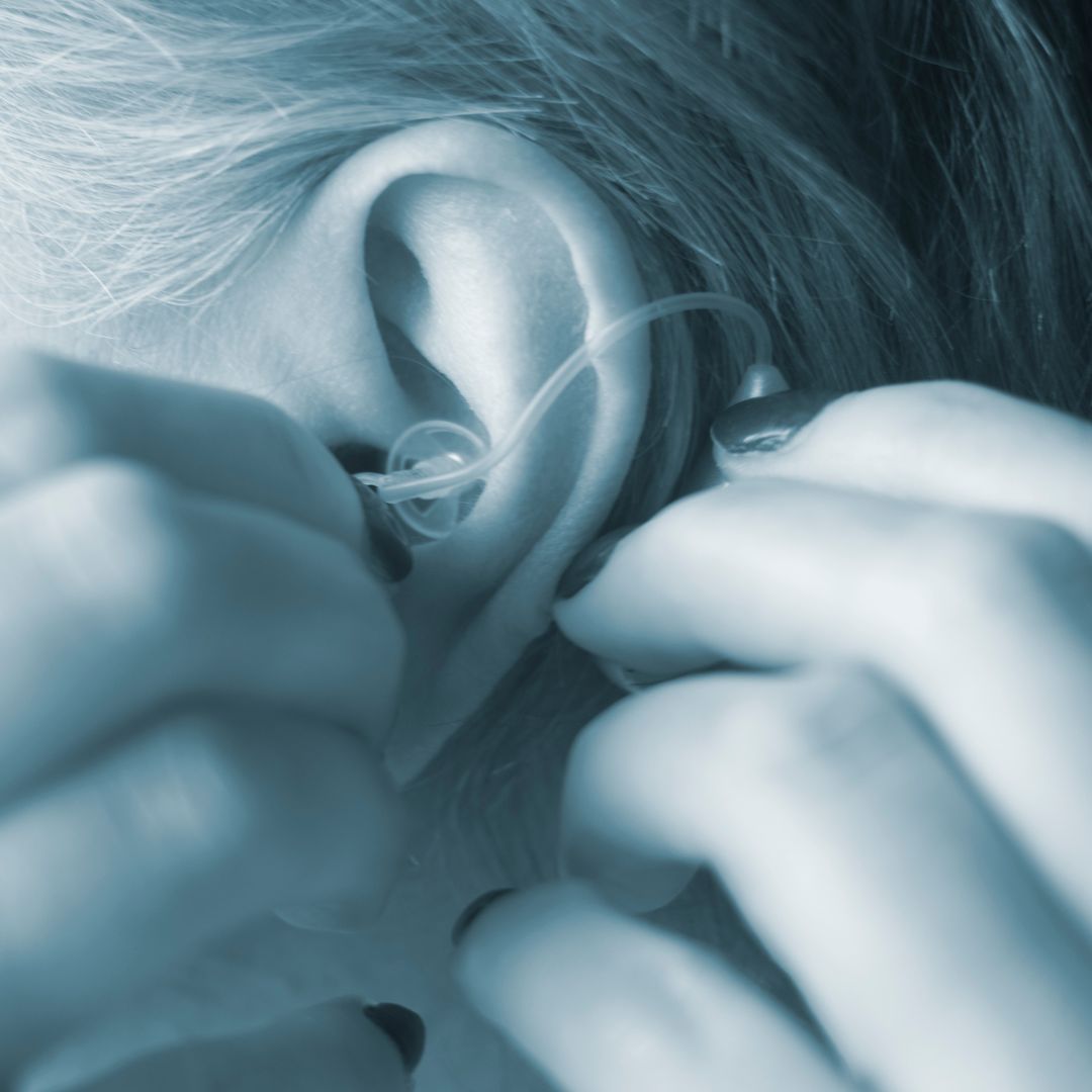 Understanding Hearing Aid Feedback Effective Solutions for Whistling