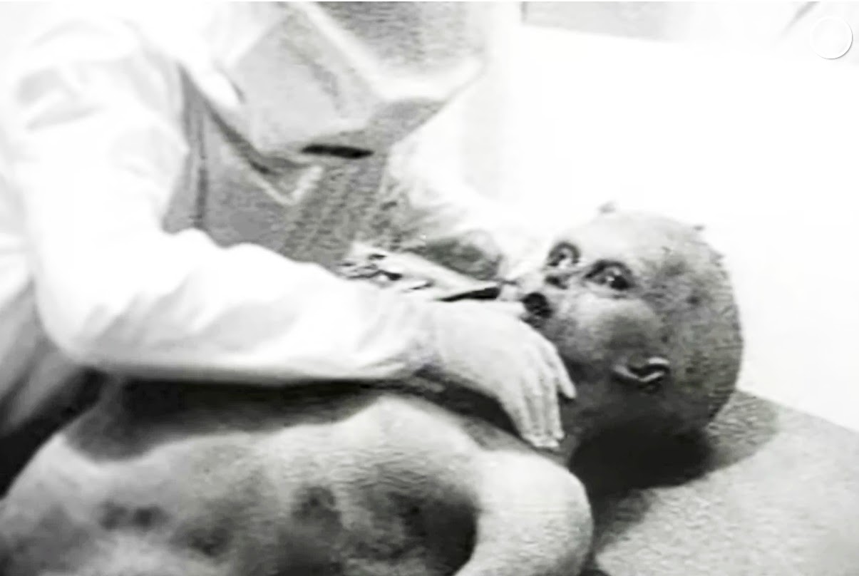 Alien autopsy