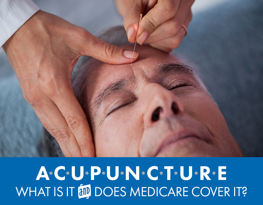 Acupuncture What Is It and Does Medicare Cover It?