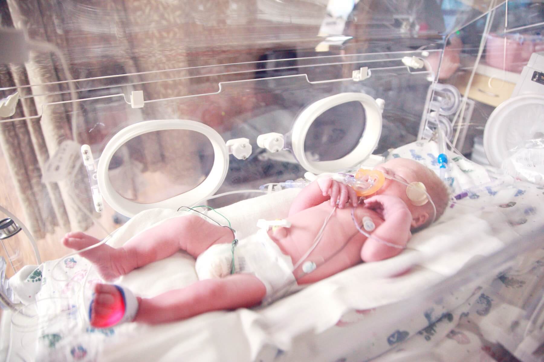 baby in incubator with cables attached neonatal nursing