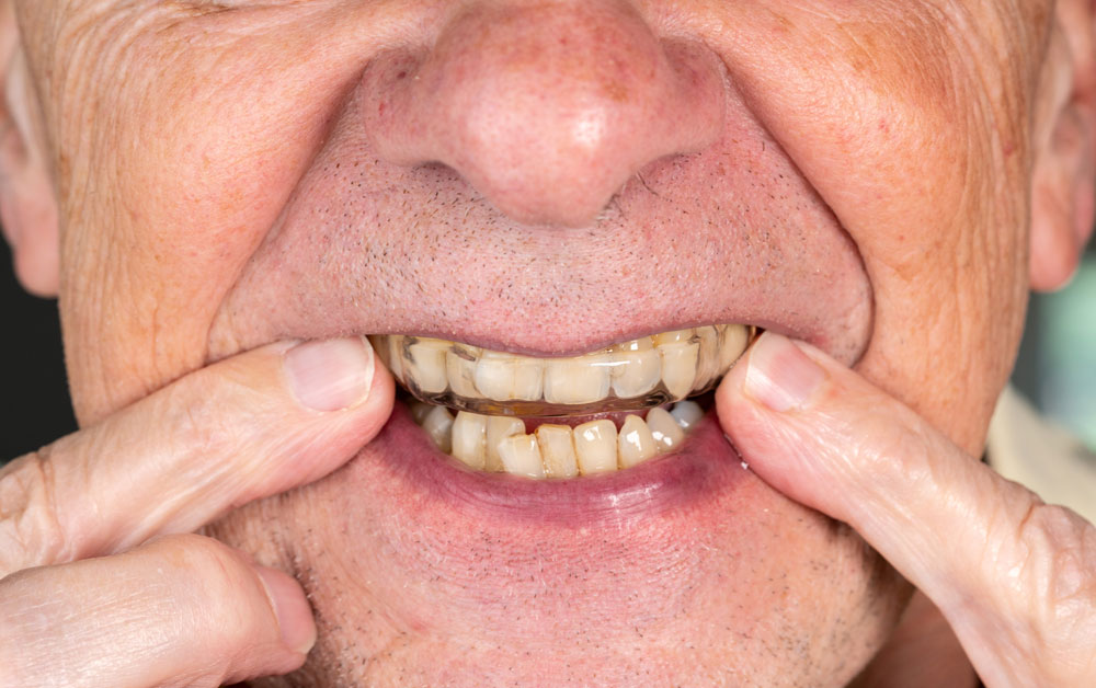 A man with significant yellow teeth stains