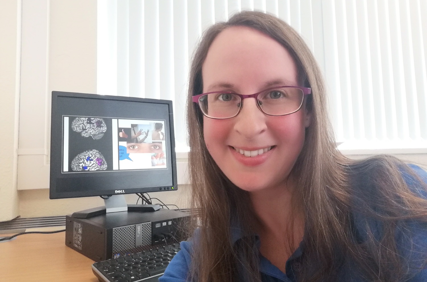 The role of multimodal cues in aphasia – Neurological research