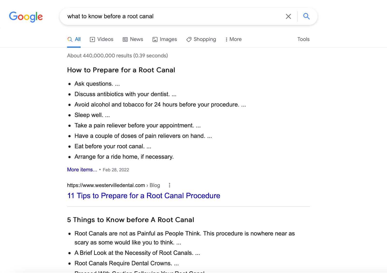 Google search results for how to prepare for a root canal