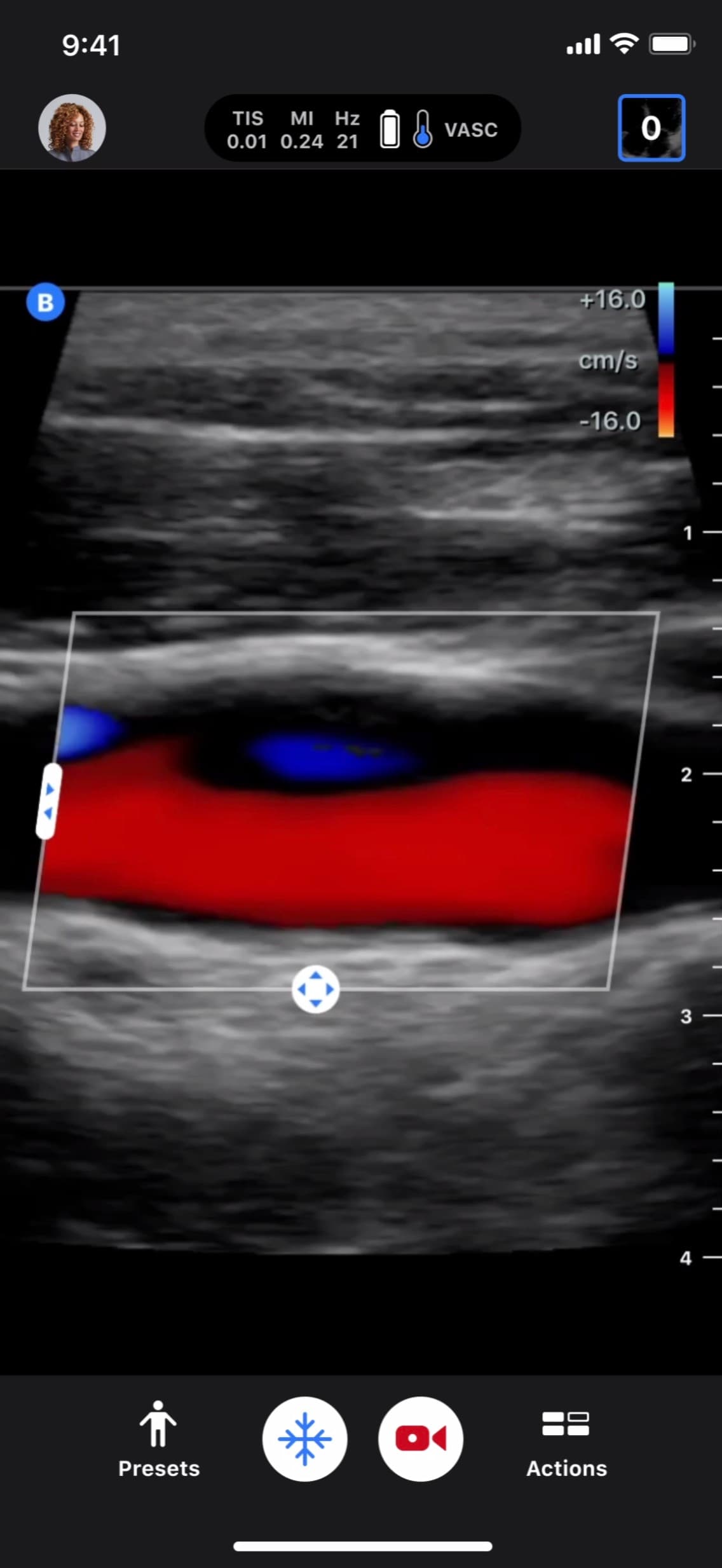 Handheld portable ultrasound machine Butterfly iQ+