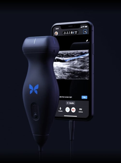 One probe, wholebody imaging Butterfly iQ+