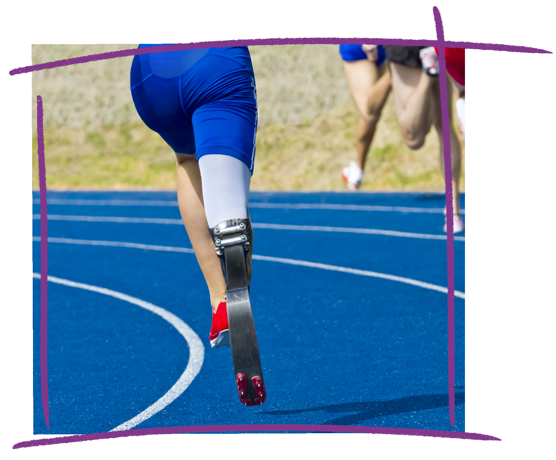 Photo of a person with a prosthetic leg running on a track