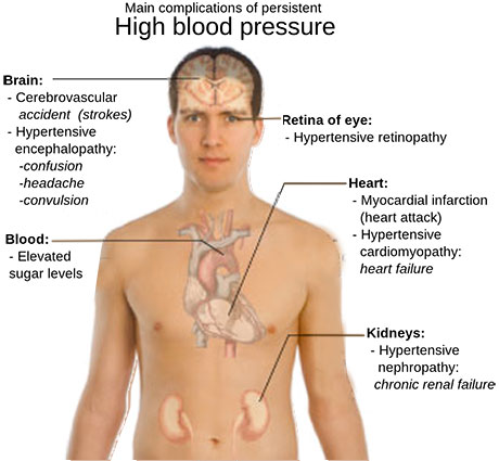 complications of hypertension
