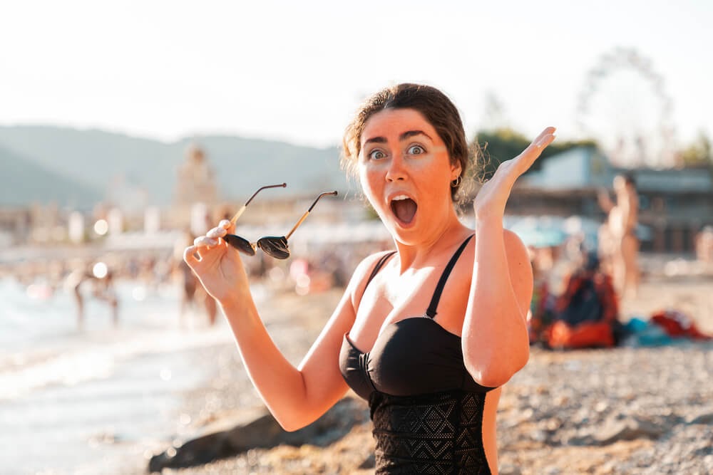 Woman pretty shocked about her intense sunburn (with matching sunglasses tan line)