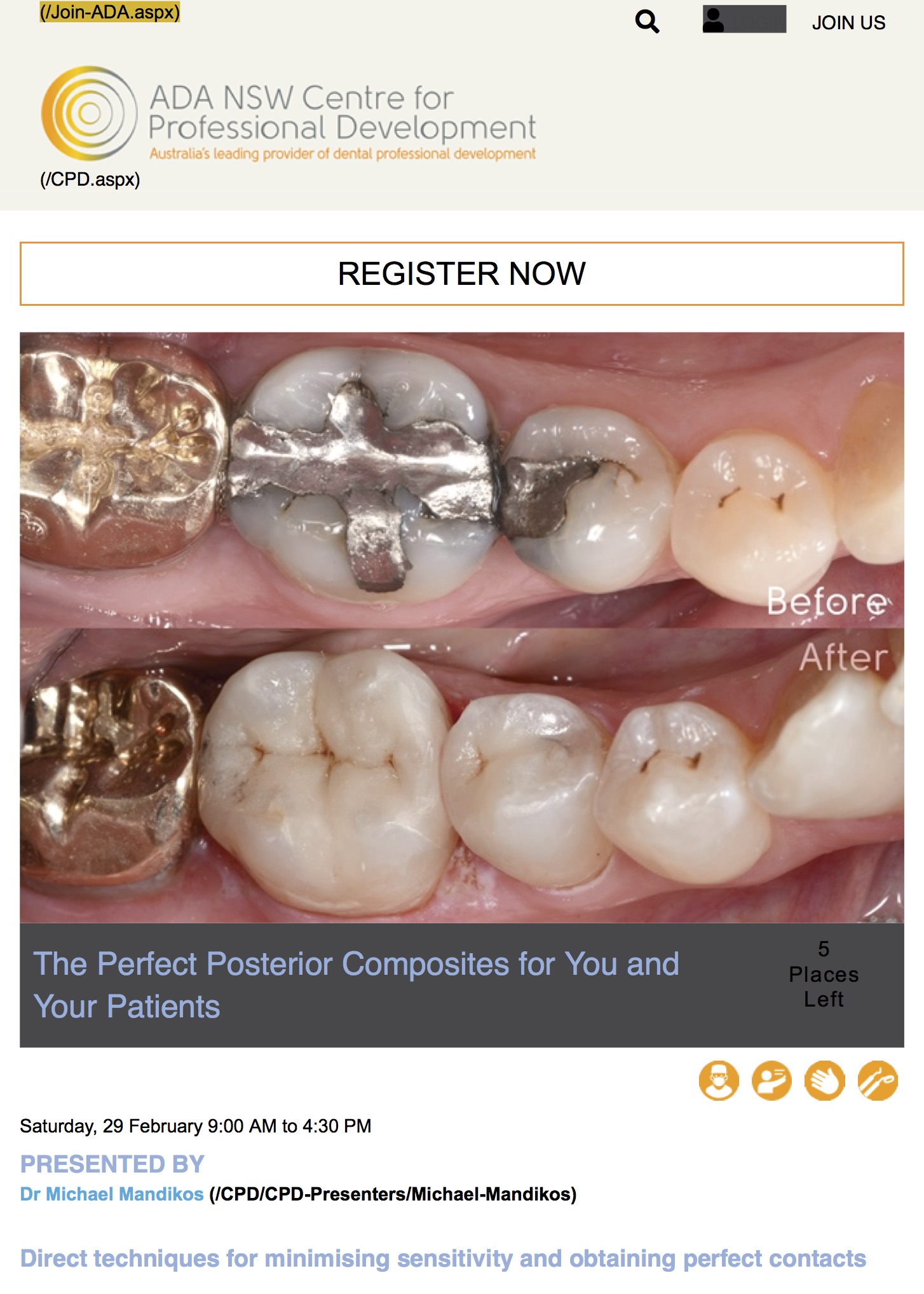 A Practical Approach To Anterior And Posterior Compos vrogue.co