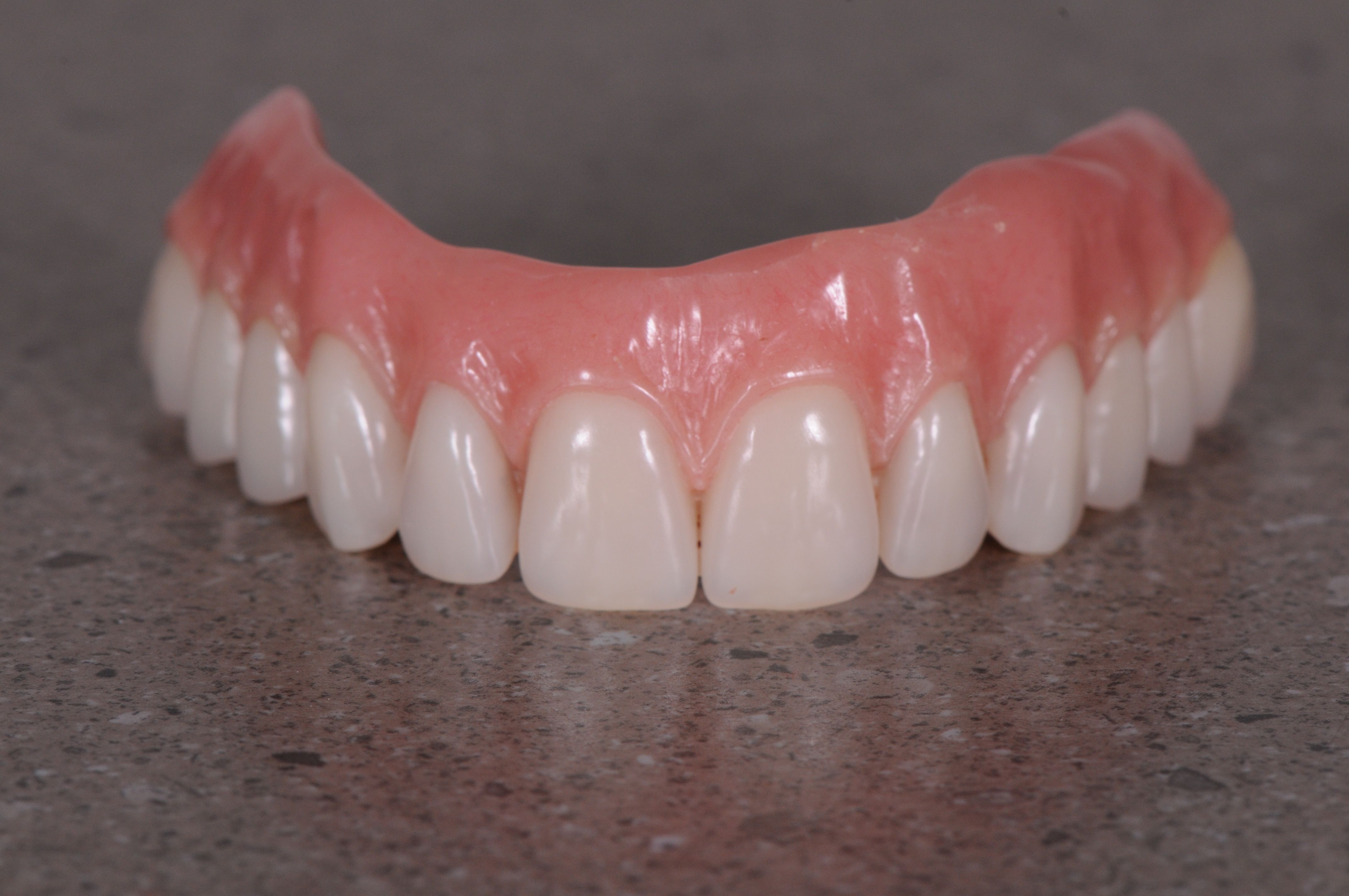 The upper arch bridge