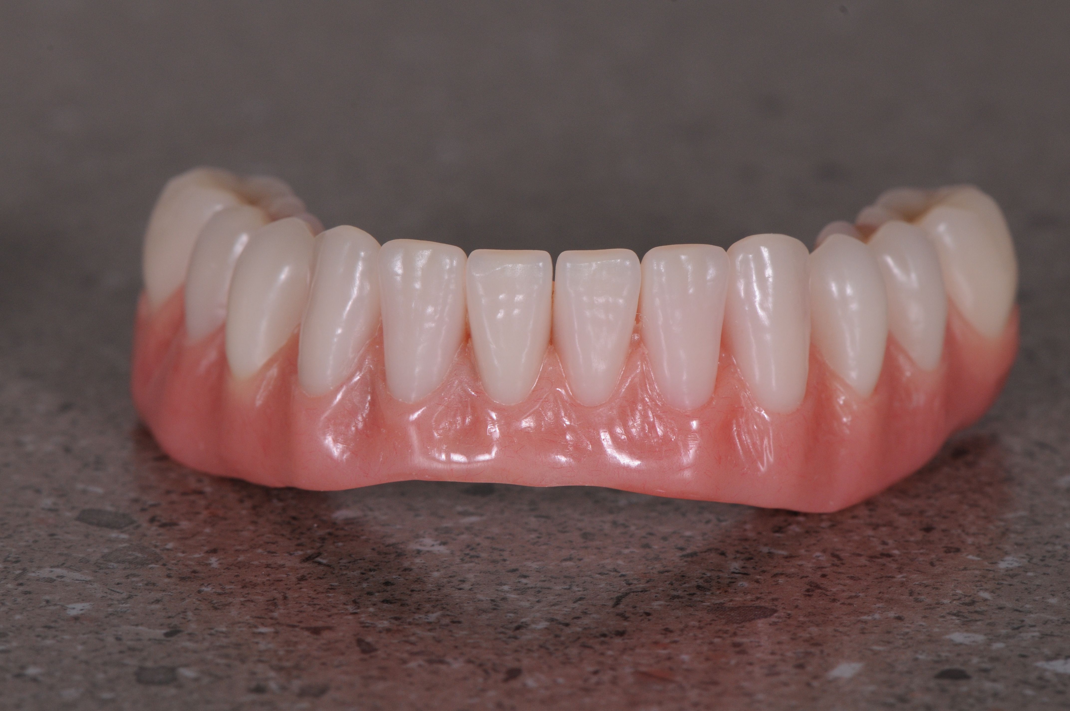 The lower arch bridge