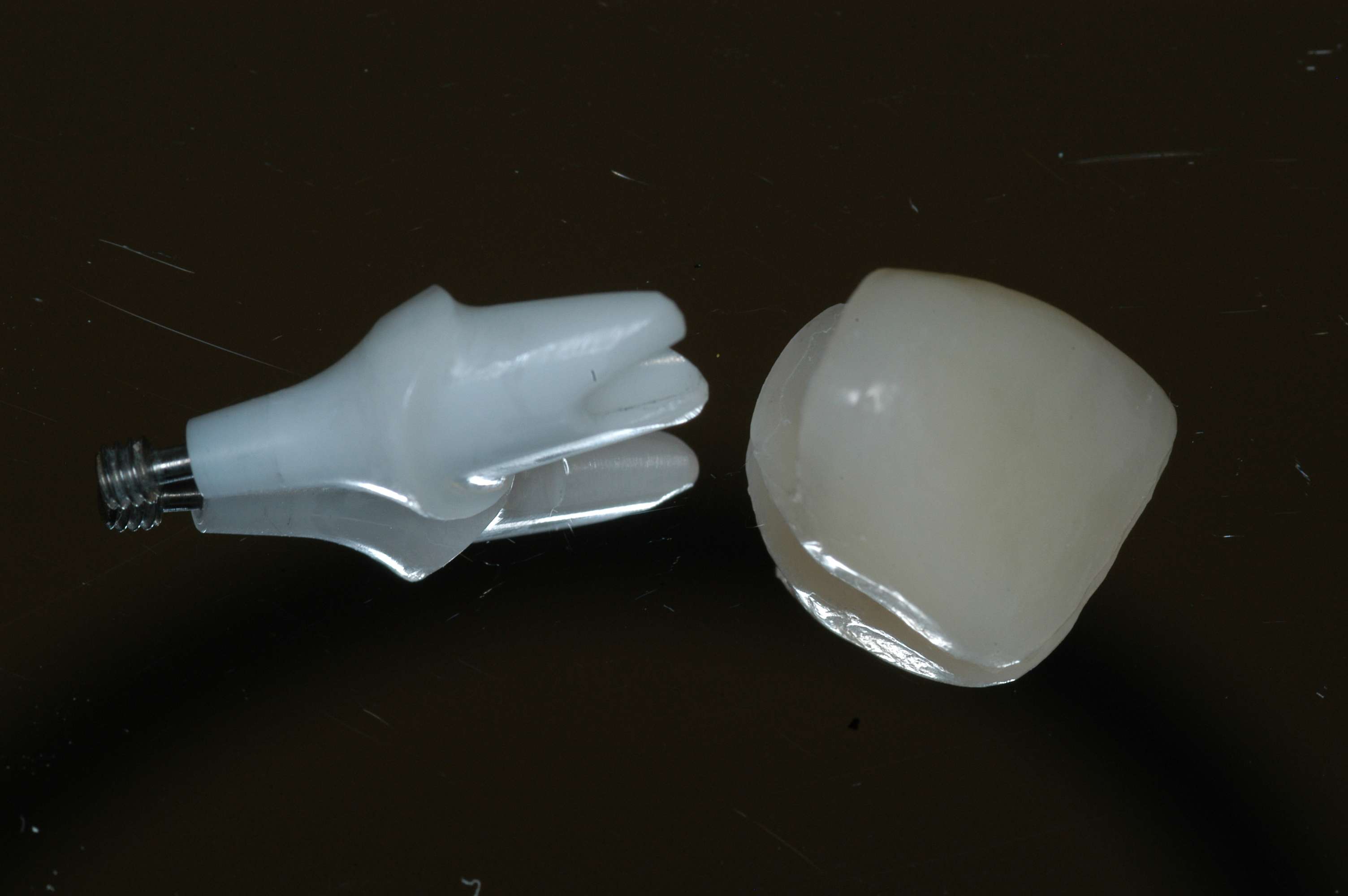 Services What is an Implant? Brisbane Prosthodontics