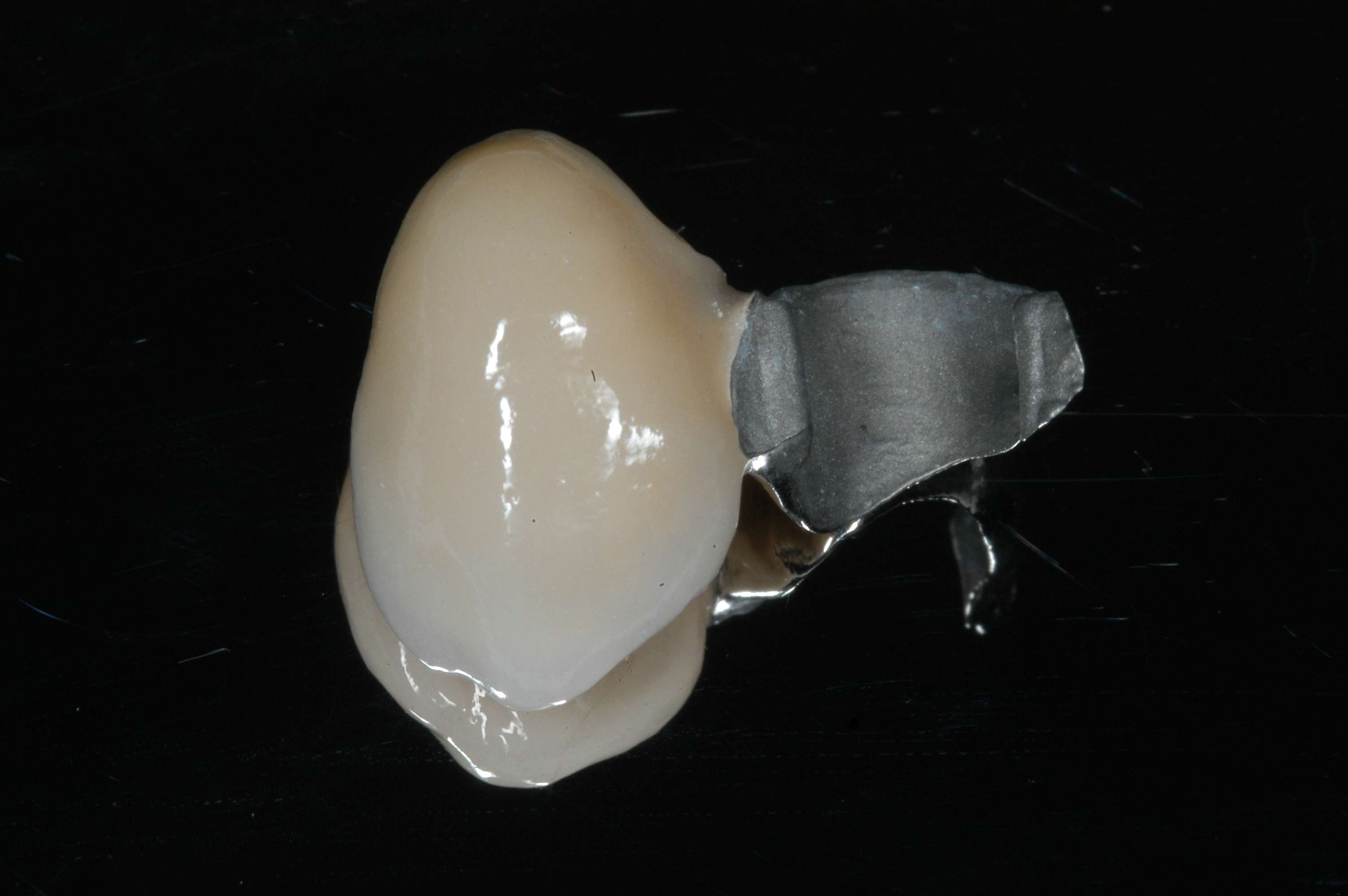 Services Bonded Bridges Brisbane Prosthodontics