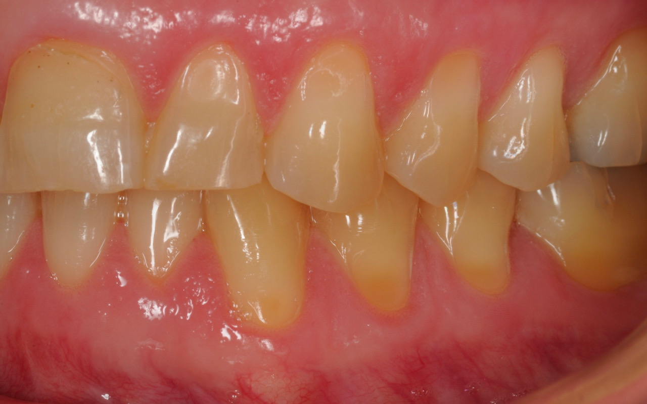 A view of the Damage