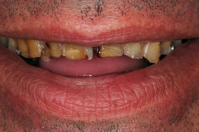 Presenting condition