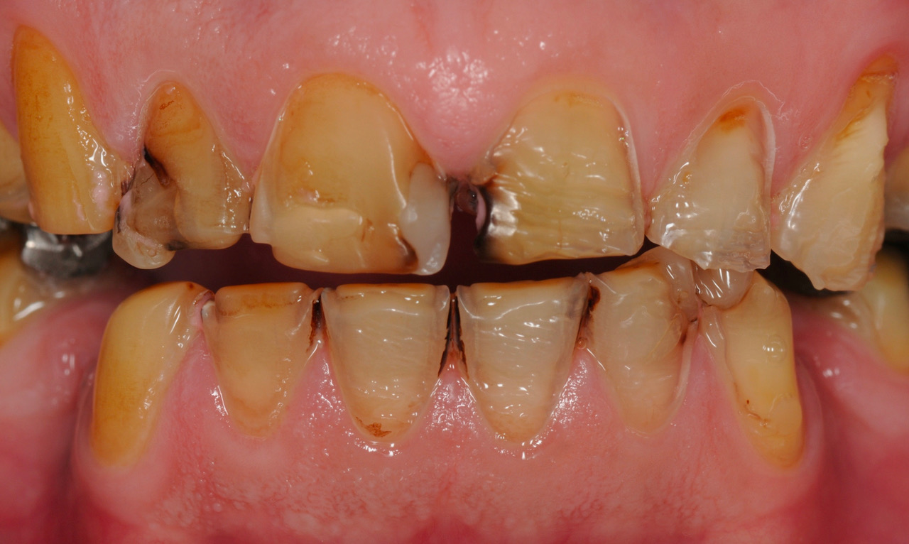 The severity of damage