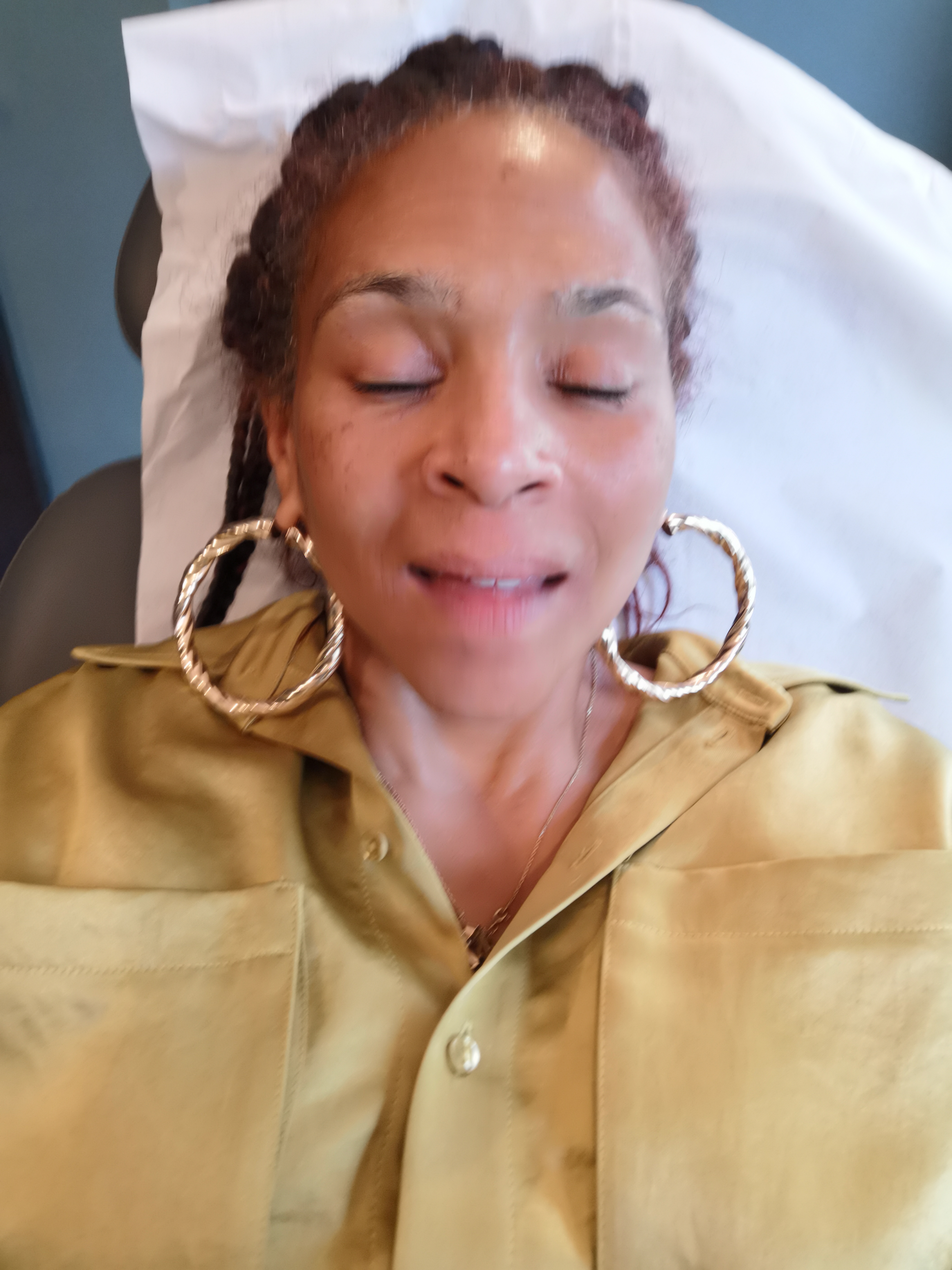 My Migraine Remedies Journey Holistic to Botox Beauty Relief