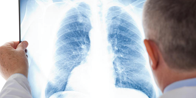 does lung cancer often spread to the brain