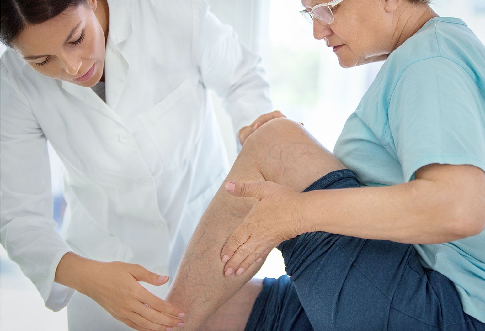 Varicose Veins: An Overview