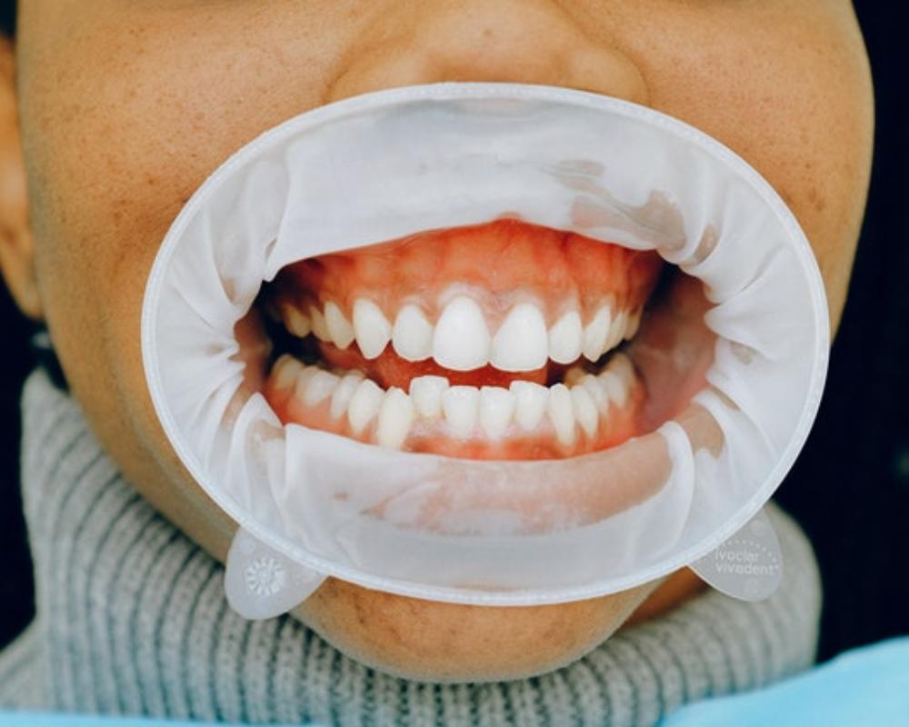 Gum Disease and Heart Disease: What Is the Connection?