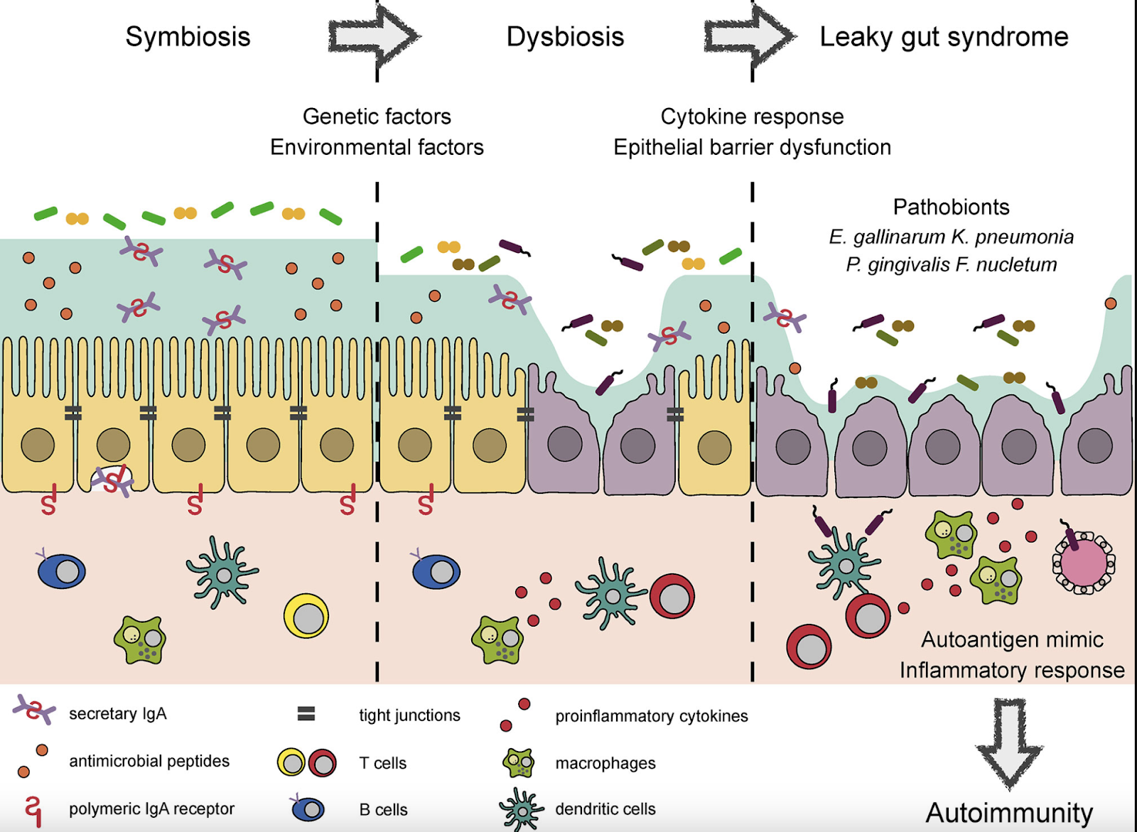 Interpreting Intestinal Permeability Lab Assessments for 'Leaky Gut