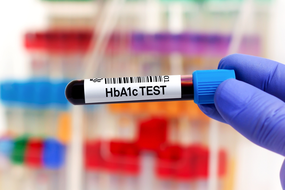 How to Interpret An HbA1c Test and What it Means For Your Patient's Health