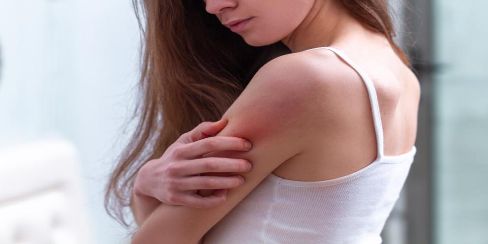 Skin Rash