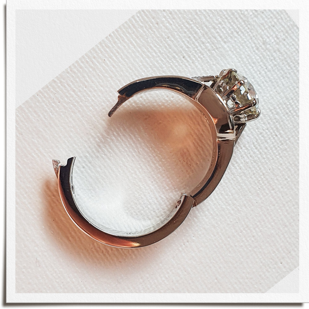 Ring Remodelling Case Study 15 Invisible Hinge for Arthritic Knuckle