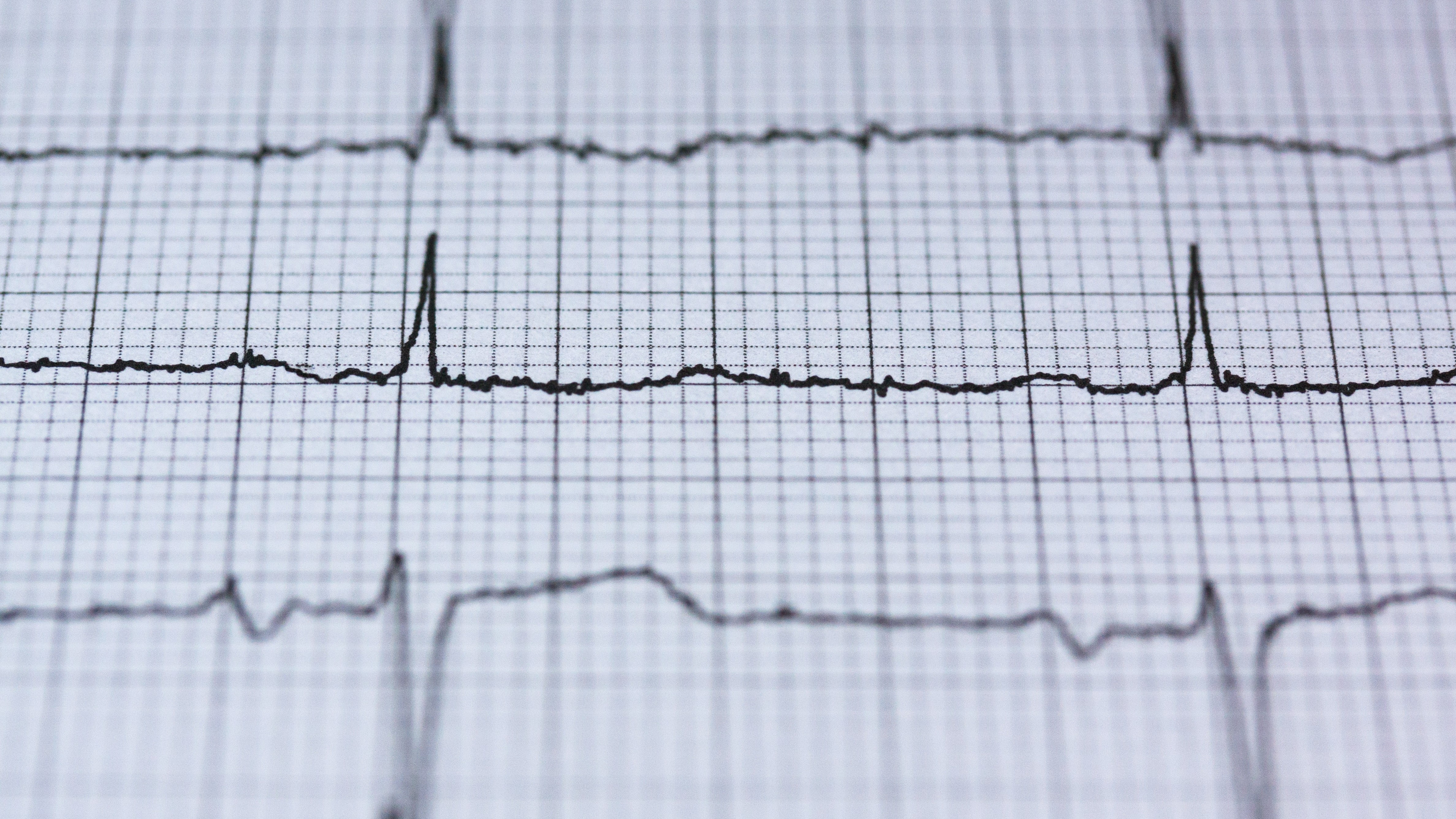 Mortality and fluctuations in macroeconomic activity in New Zealand - Vimarsana News