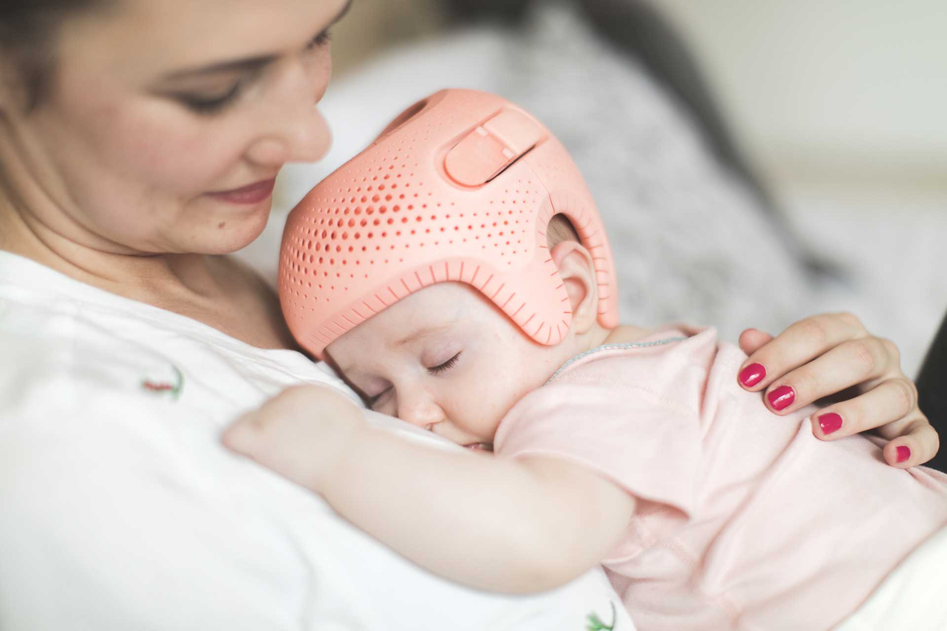 plagiocephaly helmet baby pink