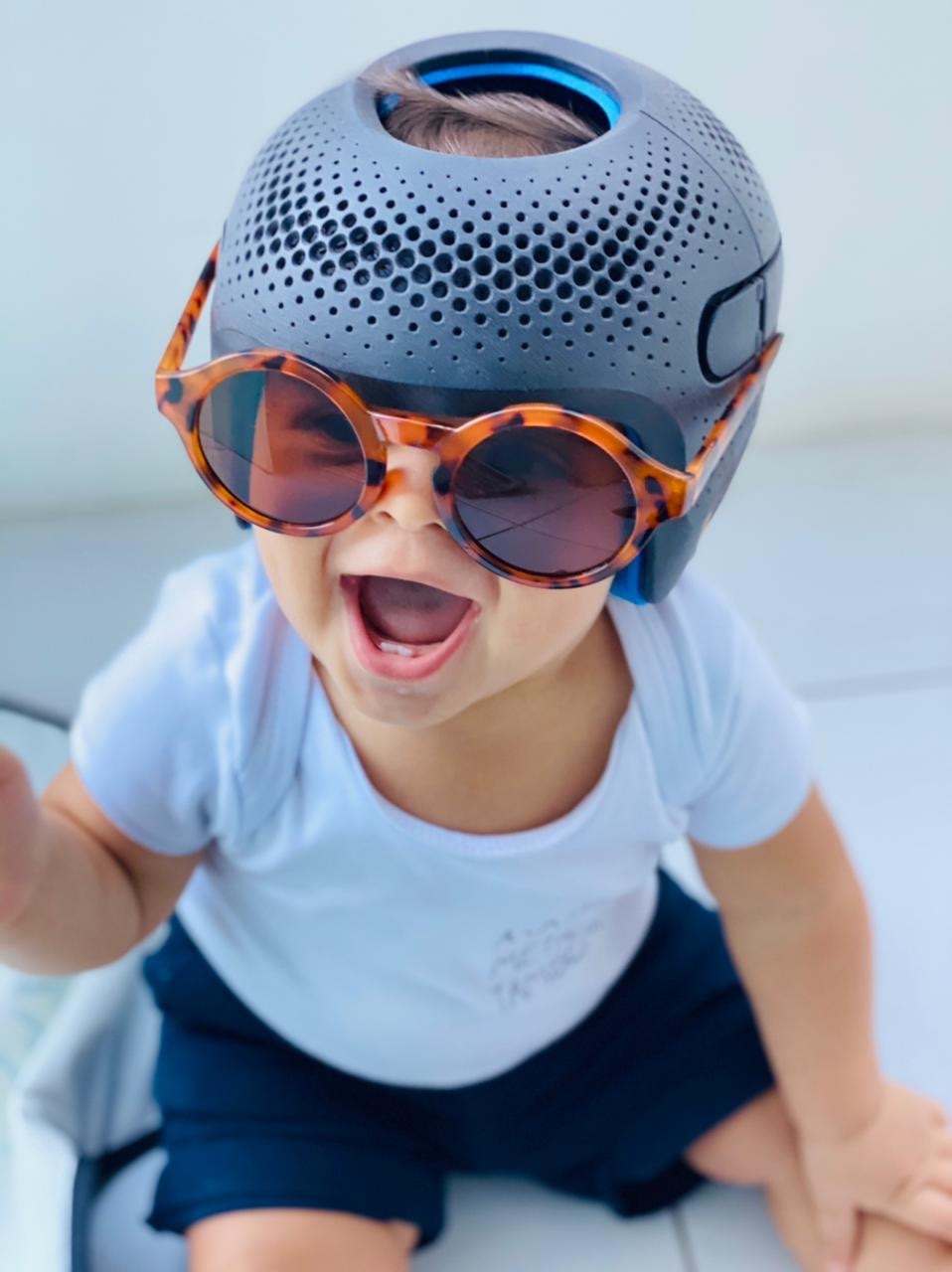 Plagiocephaly Helmets for babies Melbourne Massons Healthcare