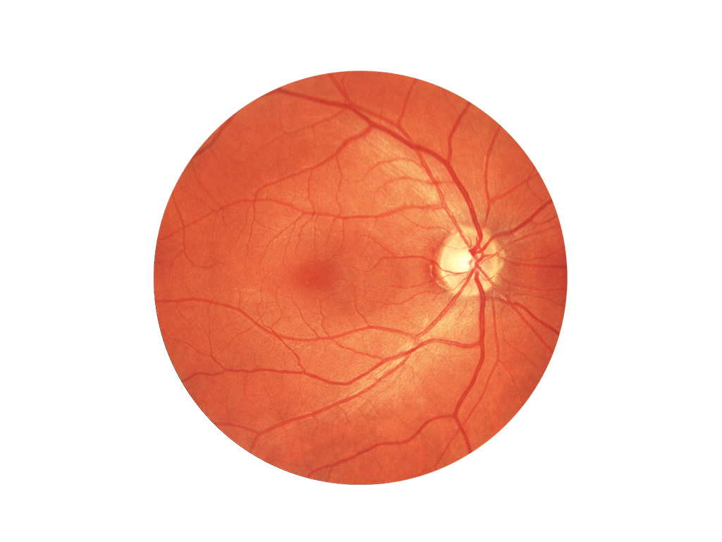 Colour fundus image