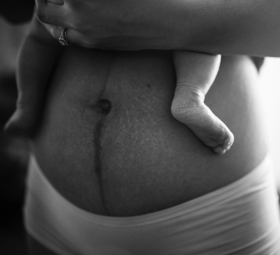 belly binding after birth
