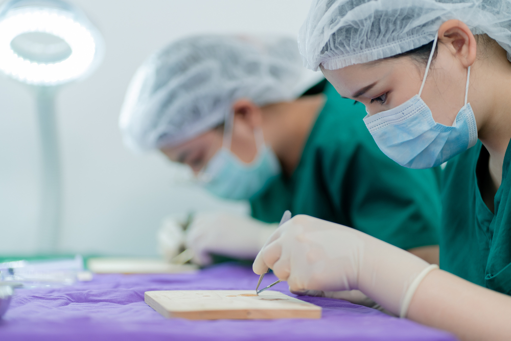 Hair Transplant Questions and Answers Este