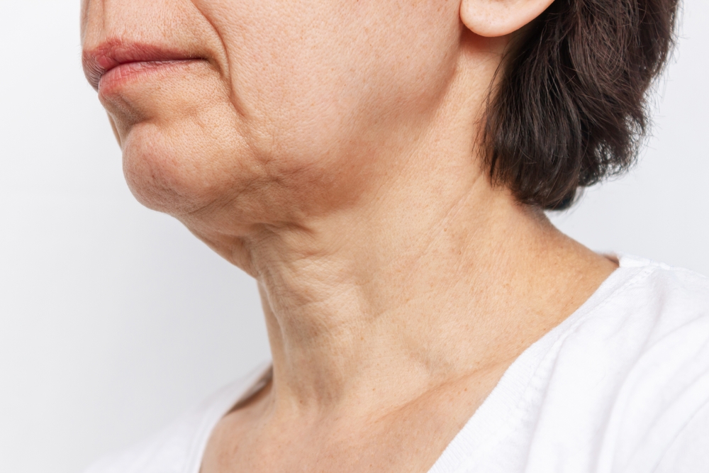 How To Get Rid Of Sagging Neck Skin Rejuvenation Este