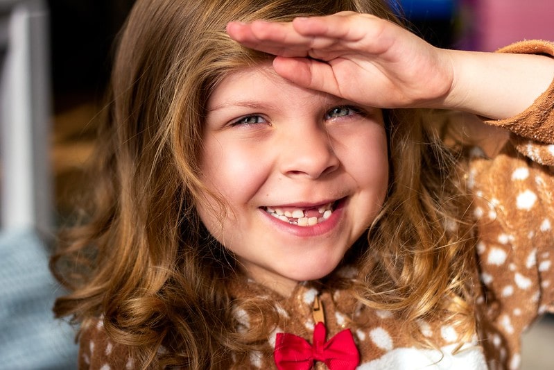 Young girl smiling with lost teeth.