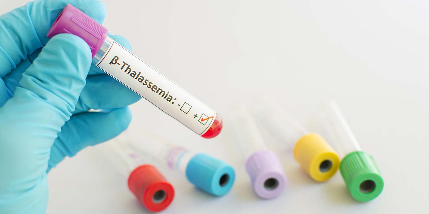 Want To Know About Beta Ce B2 Thalassemia Screening And Prenatal ...